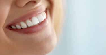 Recorte de um sorriso feminino com dentes brancos.